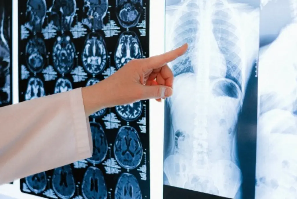 doctor checking an x-ray
